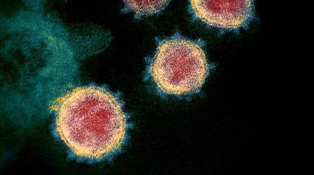 colorized transmission electron microscope image shows SARS-CoV-2—also known as 2019-nCoV, the virus that causes COVID-19—isolated from a patient in the U.S. Virus particles are shown emerging from the surface of cells cultured in the lab. The spikes on the outer edge of the virus particles give coronaviruses their name, crown-like. Credit: NIAID-RML